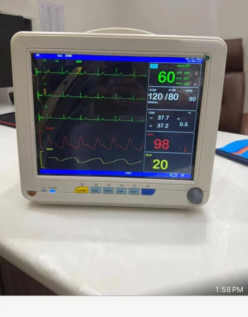 A hospital monitor displaying vital signs including heart rate, blood pressure, temperature, and oxygen saturation levels.