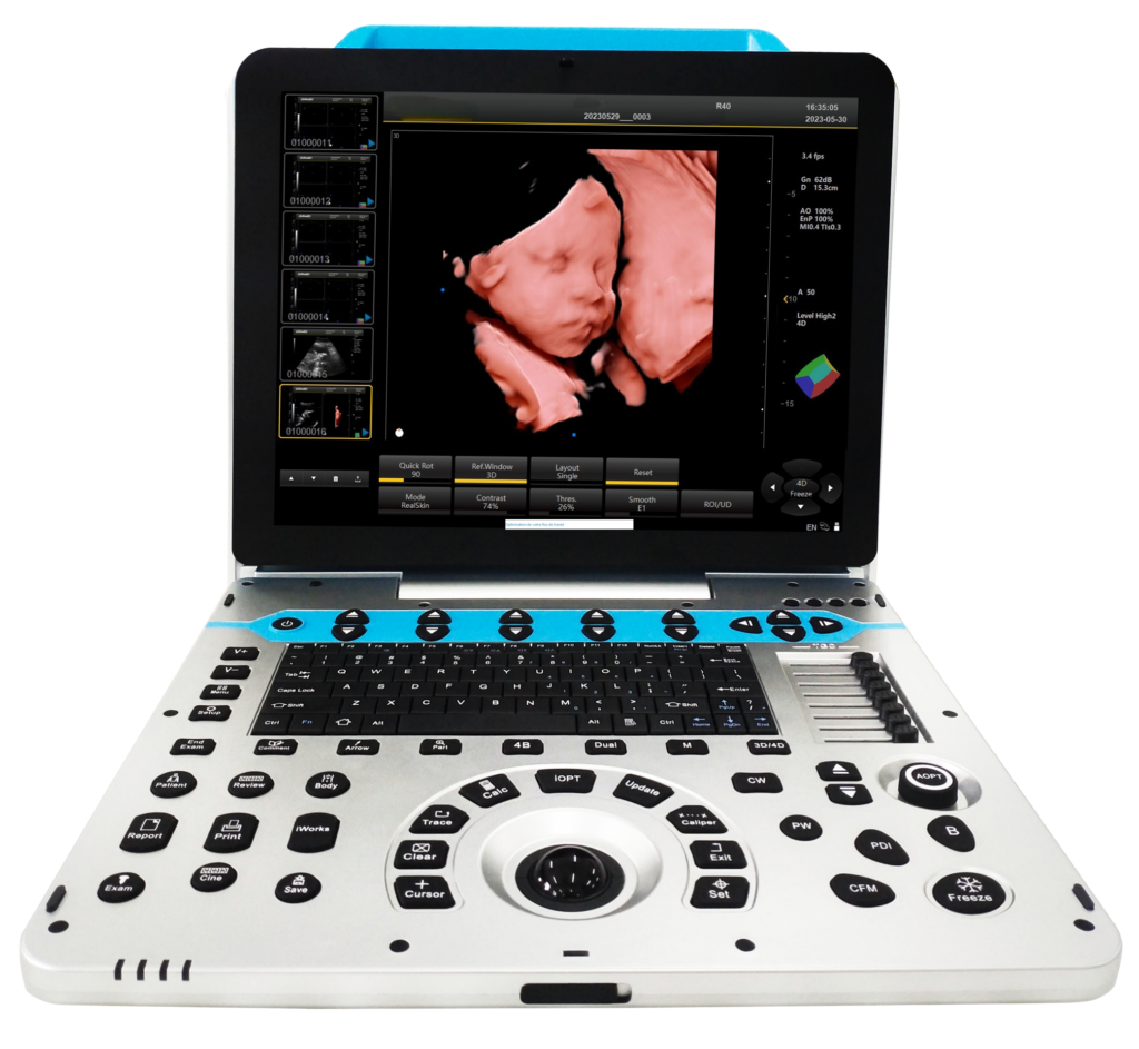 sm p30 portable full digital color ultrasonic diagnostic apparatus