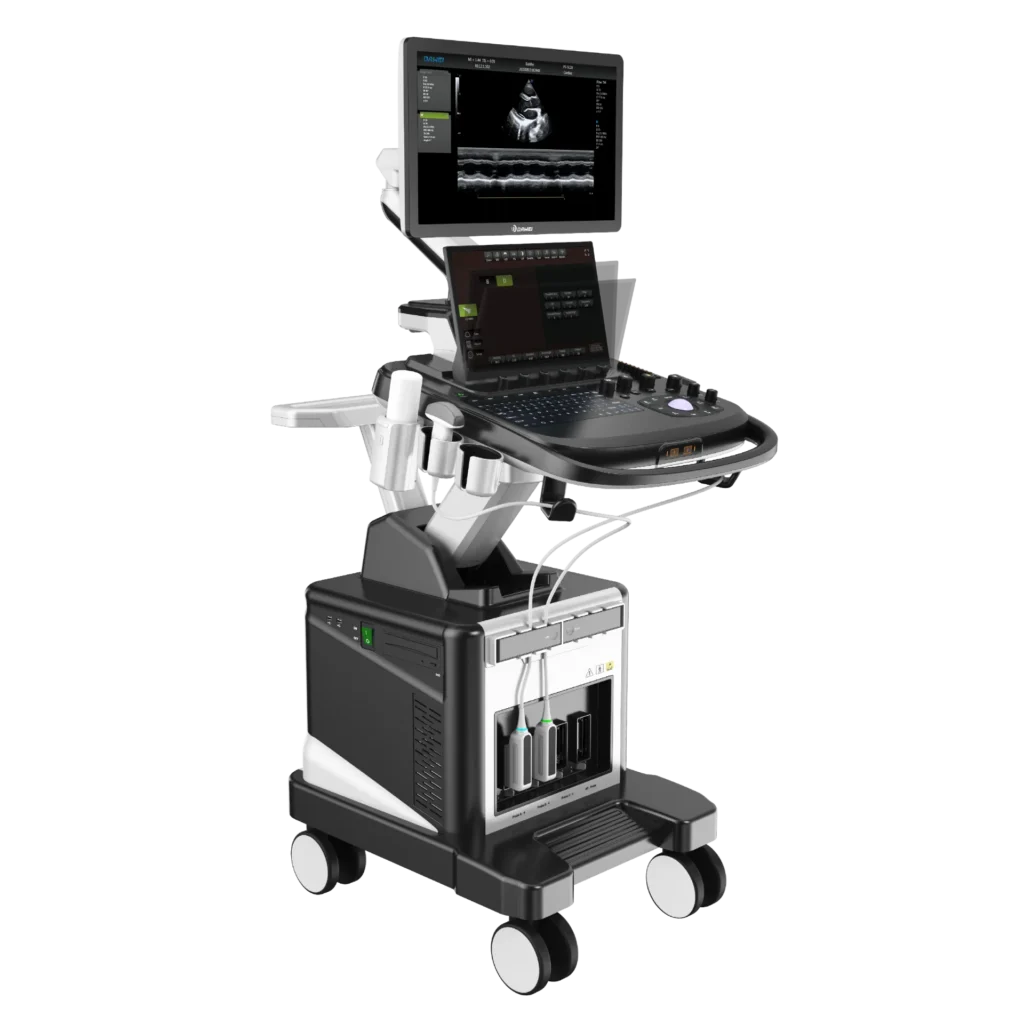 A modern medical ultrasound machine with a touchscreen, control panel, and wheeled base, displaying a medical imaging interface.