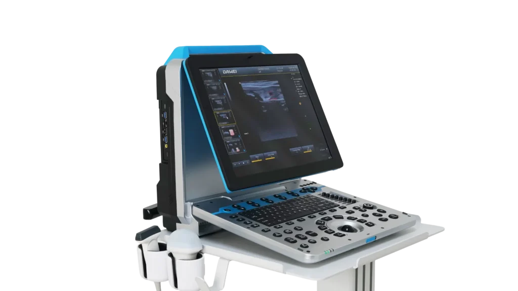 Ultrasound diagnostic machine featuring a screen displaying imaging data and a control panel with numerous buttons and a keyboard, mounted on a portable stand.