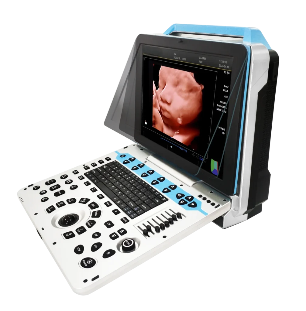 A portable ultrasound machine with a keyboard and controls, showing a detailed 3D scan image of a fetus on the display.