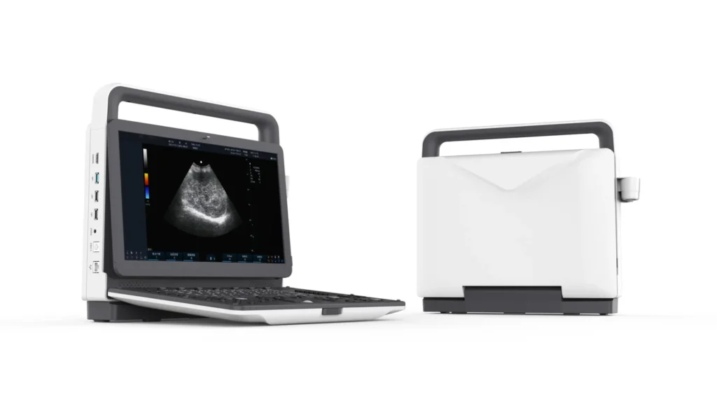 Portable ultrasound machine featuring a handle for easy transport, with open display showing an ultrasound image and a closed view of the device.