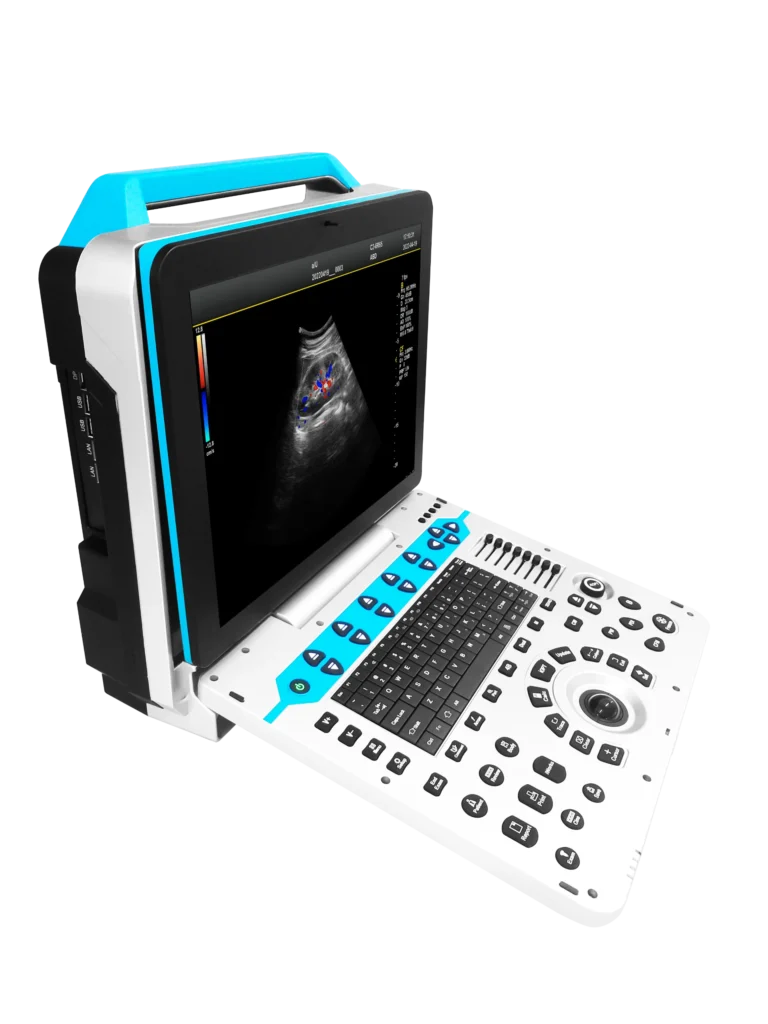 Portable ultrasound machine showing an ultrasound image on its screen and equipped with a keyboard and controls.
