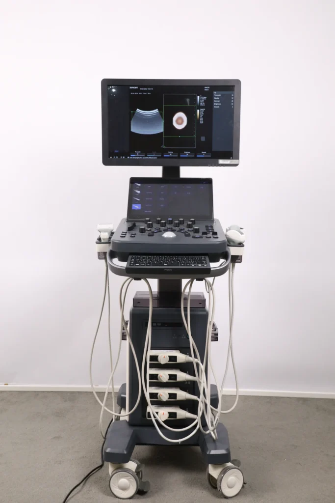Advanced ultrasound machine with a monitor displaying a medical scan, probes attached, control panel, and casters in a clinical setting.